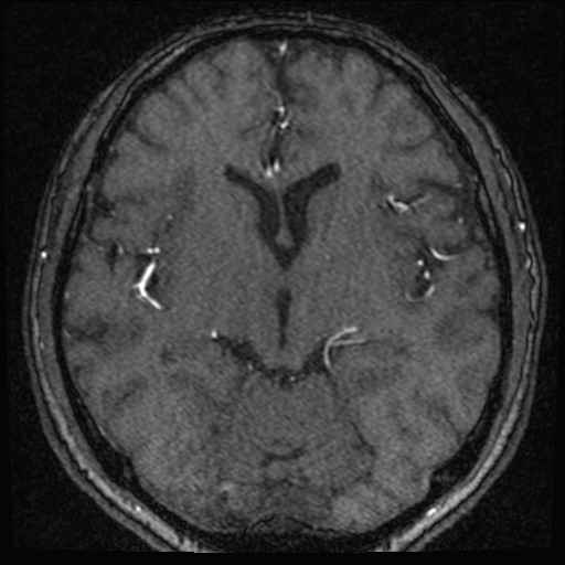 Click on the Serie image to view the images of VILLANUEVA, WILLIAM A.